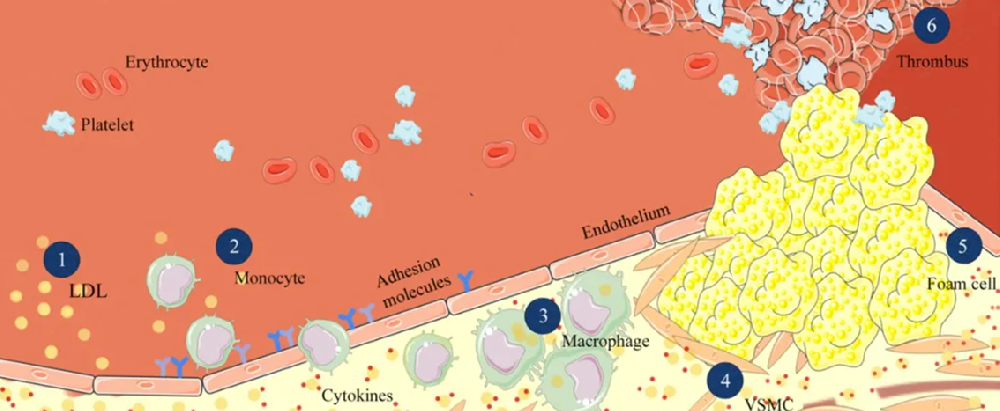 1700027709275403.png 33333.png